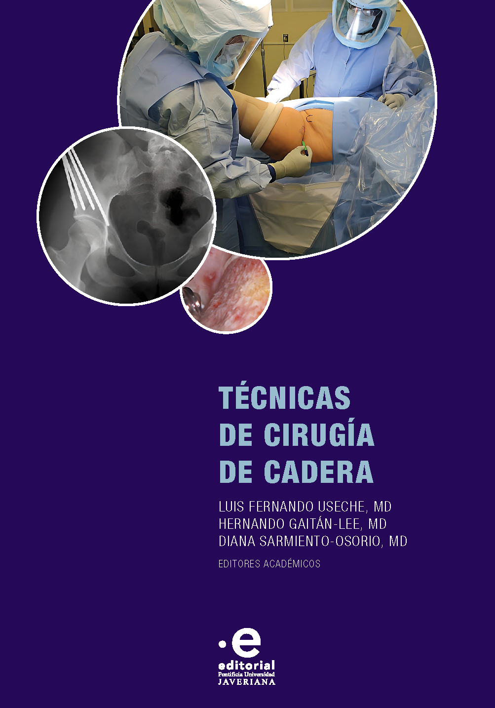 Técnicas de cirugía de cadera Portada